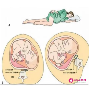 孕妇左侧睡体内胎儿图
